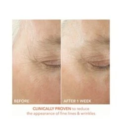 Dr Dennis Gross Alpha Beta Ultra Gentle Daily Peel 8 Dr Dennis Gross Alpha Beta Ultra Gentle Daily Peel -Care Products Alpha Beta Ultra Gentle Daily Peel add2 65347 812 general