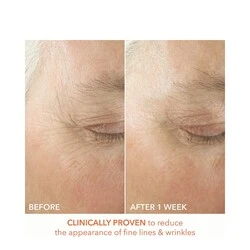 Dr Dennis Gross Alpha Beta Ultra Gentle Daily Peel 5 Dr Dennis Gross Alpha Beta Ultra Gentle Daily Peel - Image 3