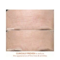 Dr Dennis Gross Alpha Beta Ultra Gentle Daily Peel 9 Dr Dennis Gross Alpha Beta Ultra Gentle Daily Peel -Care Products Alpha Beta Ultra Gentle Daily Peel add3 65347 7832 general