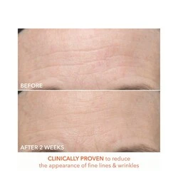 Dr Dennis Gross Alpha Beta Ultra Gentle Daily Peel 6 Dr Dennis Gross Alpha Beta Ultra Gentle Daily Peel - Image 4