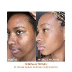 Dr Dennis Gross Alpha Beta Universal Daily Peel -Care Products Alpha Beta Universal Daily Peel add4 55577 3617 general