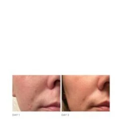 Dr Dennis Gross DRx Acne Eliminating Gel -Care Products DRx Acne Eliminating Gel add5 65307 6090 general